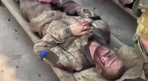 Lots of blood and pain. Broken and wounded Ukrainians fell into Russian captivity, as usual