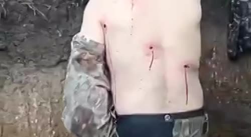 Soldier got multiple wounds from shrapnel