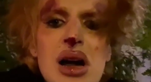 Off Duty Transgender Soldier Attacked on Live Stream