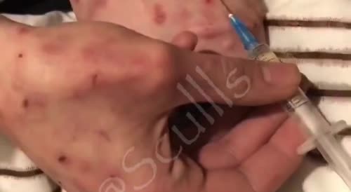Girl Injects Drugs then Fades Away