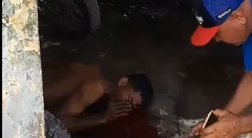Man Bleeds Out After Machete Attack