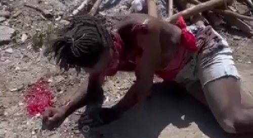 Member Of "Chandelle" Resistance Group Set On Fire In Haiti