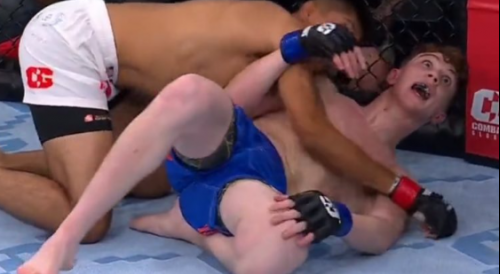 MMA Fighter Suffers Terrible Leg Injury
