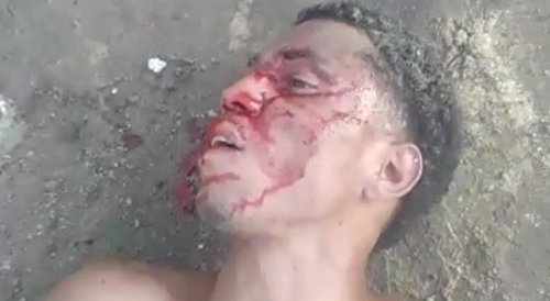 Shooting Victim Filmed Vomiting Blood In The Streets Of Brazil