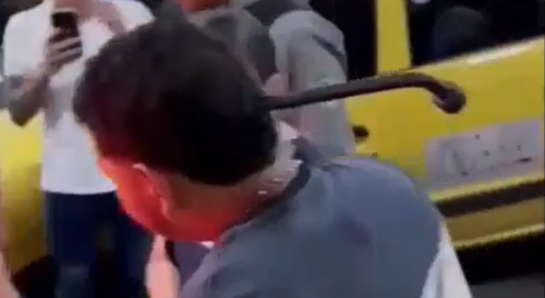 Wrench Left In The Head After Fight Of Taxi Drivers In Colombia