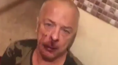 Junkies Beat Disabled Army Vet, Accuse Him of Being A Predator