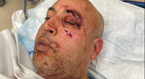 NYPD Cop Attacked By Thugs
