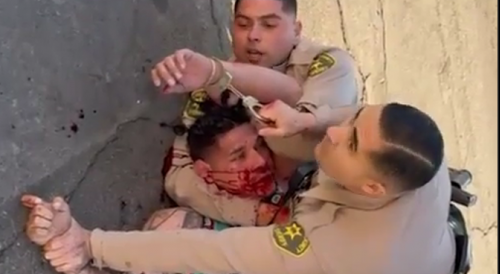 LAPD Put Amputee In Headlock, Punch Him Silly