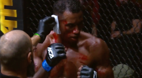 MMA fighter's cauliflower ear bursts open from an elbow