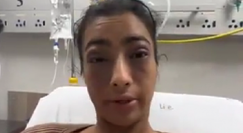 D-Cup Girl Got A Life Threatening Allergic Reaction