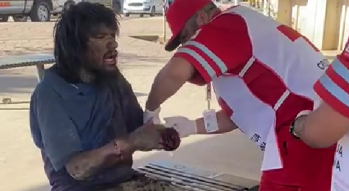 Homeless Man Lost Hand In Machete Fight