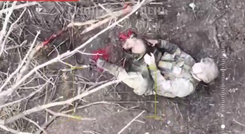 Ukrainian soldier loses his leg.