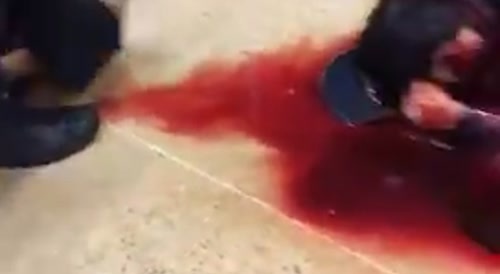 Blood Squirting Out Of Robber's Neck After Getting Shot