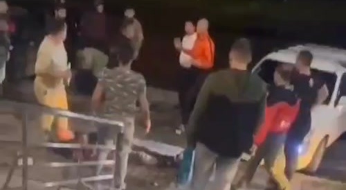 Man Hospitalized With Skull Fracture And Broken Jaw After Fight Outside The Bar In Russia