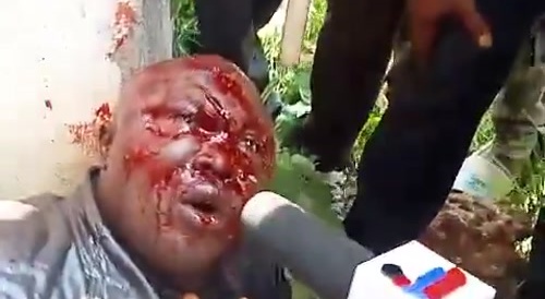 Kenya: Interview For TV With Hired Goon Who Tried To Disrupt Protests Looks Like Interrogation
