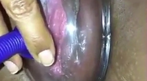 vaginal suction