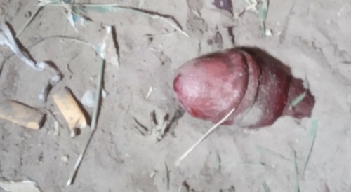 Severed penis found in the park
