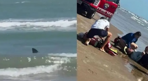 Shark Attack on Woman In Texas