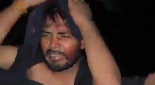 Goons kidnapped a Dalit youth at gunpoint, took him to the forest and beat himl