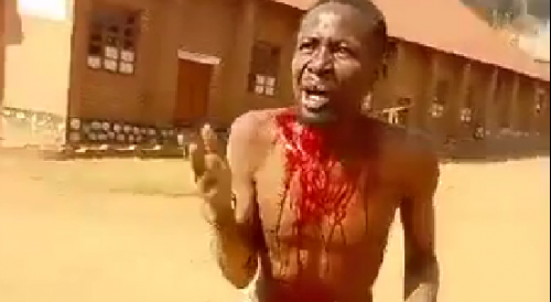 Man Brutalized For Being Rwandan In Congo