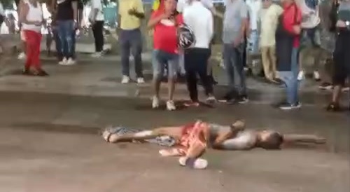 Victim Of Hit And Run In Colombia