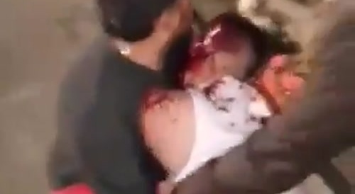 Protester Shot In The Head By Maduro`s Sniper