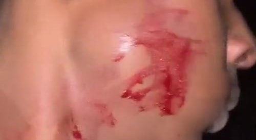 Gang member gets face sliced for stealing drugs