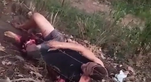 Motorcyclist Has Arm And Leg Destroyed In Accident