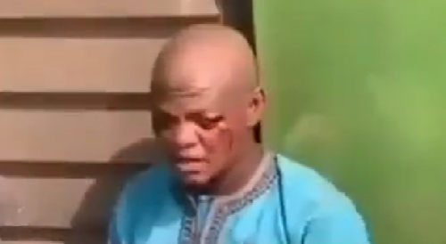 Ritualist Caught With A Human Head