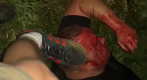 Neo-Nazi Skinheads beat up pedophiles in Russia