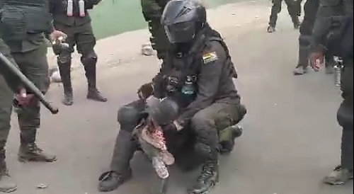 Bolivian Officer Lost Leg During Protests