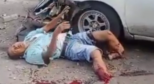 Indonesian Trucker Loses Feet In Freaky Accident