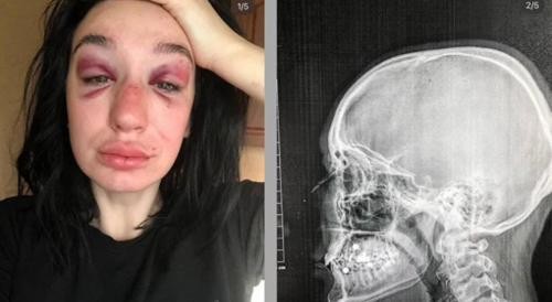 Female Bartender Attacked After Refusing To Sell Vodka