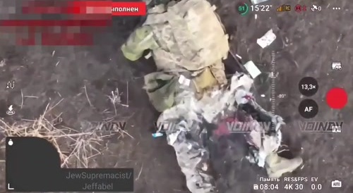 Ukrainian special forces soldier with broken legs.