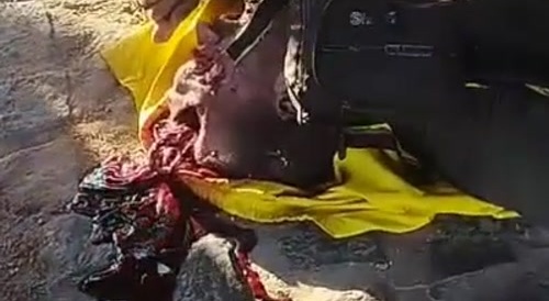 Skull Cracked After Motorcycle Accident In Brazil