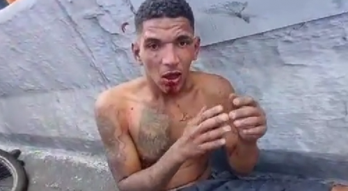 Result Of Robbing A Delivery Man On The Busy Street In Brazil