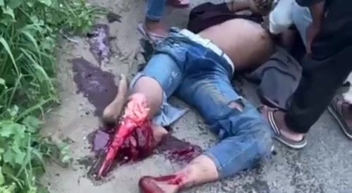 Cambodian Moped Rider Suffers Gruesome Injury