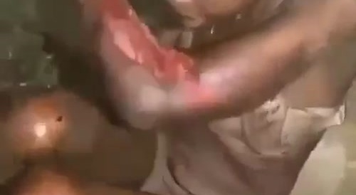 Zombie Bitch Eats Chunks Of Her Own Flesh