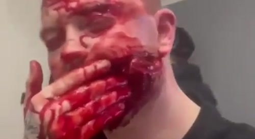 Man shot in the face in Bristol, England (Warning, graphic)