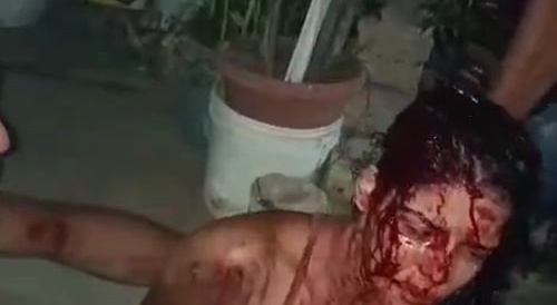 A woman was stabbed in the city of Maceió (BRASIL)