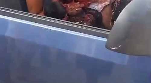 A man had his head crushed (gore)