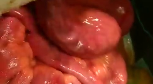 Gut Worms (Extended)