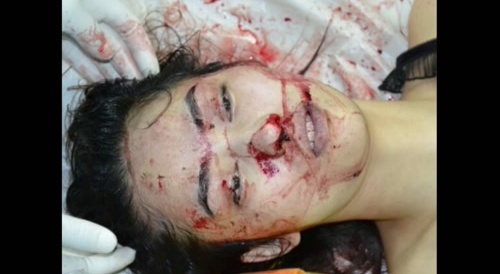 * ASIAN DEAD 4* . Forensic photos(police) of murdered Asian. (video slideshow)