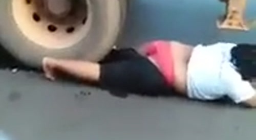 Woman gets Leg Crushed by Big Truck