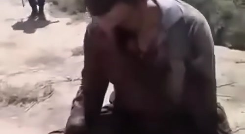 ISIS militant still alive with a destroyed face