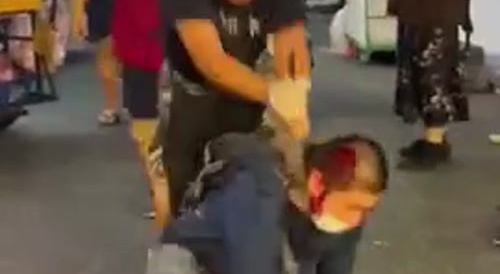 Man gets Stabbed in Eye and Head