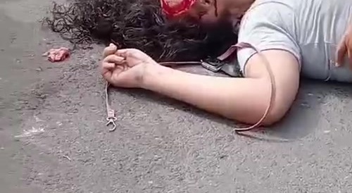 Her head split the fuck open