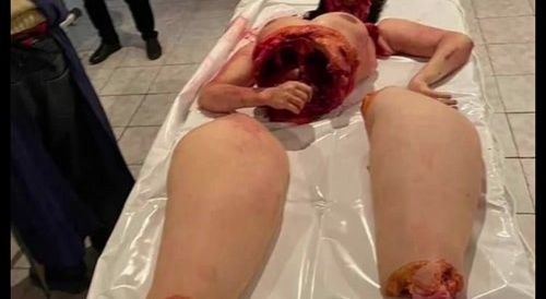 Dismembered woman (before and after)