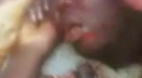 Dead man gets eye ripped out