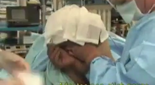 Transfemoral amputation surgery.